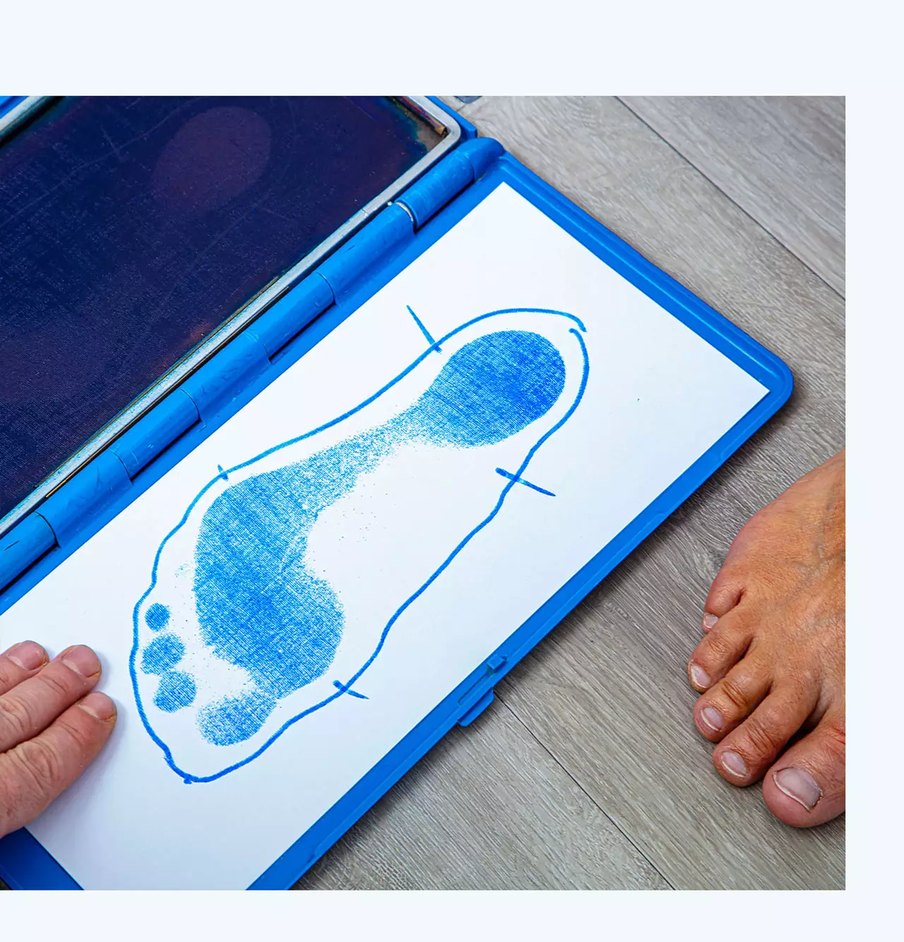 Ablauf orthopädische Fußversorgung, gezeichneter Fuß mit Blauabdruck