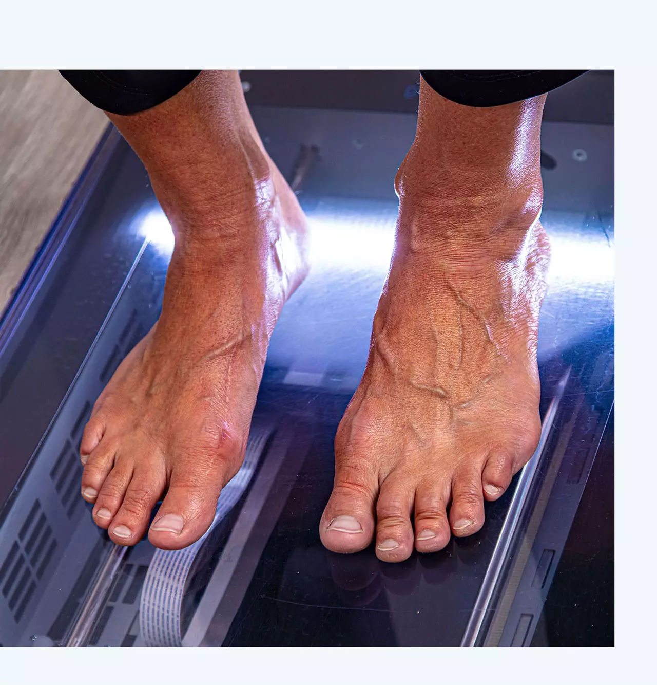 Ablauf orthopädische Fußversorgung, Messen der Druckverteilung, Scannen der Füße